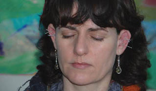 Relaxation with acupuncture